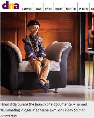 8倍の速さで年老いた14歳の少年（112歳）が語った「死ぬ前にしたい3のこと」の画像2