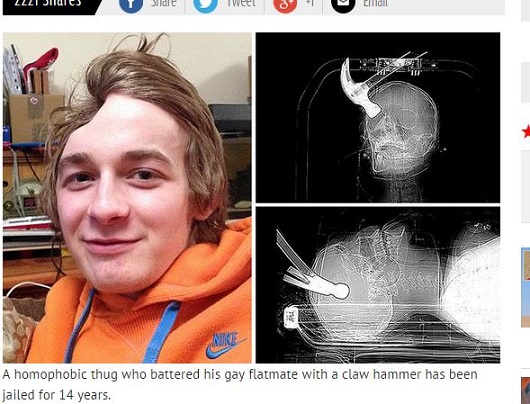 反同性愛者がルームメイト18歳の頭をハンマーで殴った結果…！の画像1
