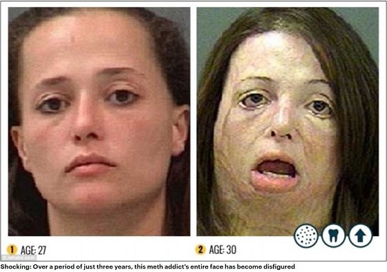 人間、やめますか？ ― ハードドラッグにハマった女性たちの顔面激劣化（モンスター化）がヤバい！の画像1