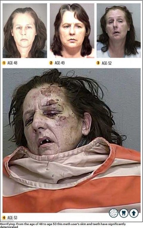 人間、やめますか？ ― ハードドラッグにハマった女性たちの顔面激劣化（モンスター化）がヤバい！の画像2