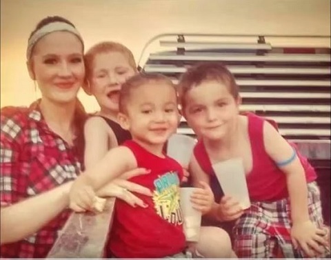 【閲覧注意？】日焼けでできた巨大水ぶくれがヤバすぎる!! 死をも招く恐怖の紫外線!!＝米・オクラホマの画像1