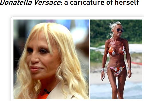 デコボコの肌や腫れ上がった瞼… 美容整形に取りつかれた世界の女たちの「成れの果て」の画像4