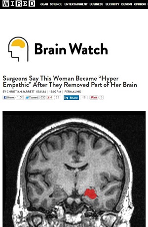 手術で心の中が見えるようになった女性 ― 人間は機能を失うと「超能力」が開花する！の画像1