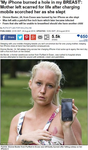 【iPhone 6は大丈夫？】胸にまさかの大ヤケド！ iPhone充電中に起きた大悲劇の画像1