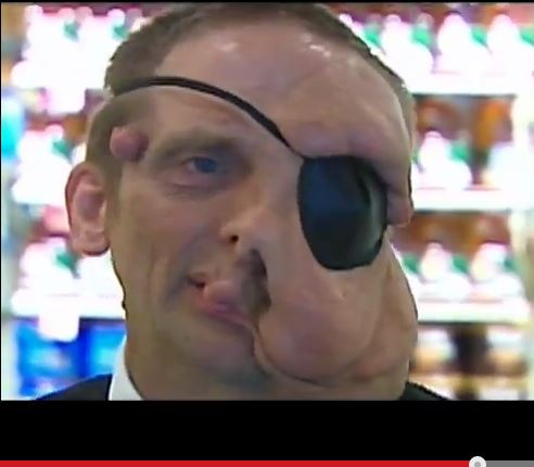 【エレファントマン】体の一部が極端に肥大する男「これが私の生きる道」の画像1