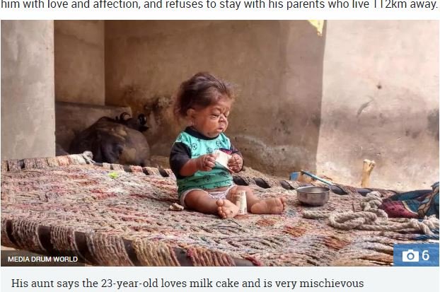 赤ん坊の身体に閉じ込められた23歳の男 ― 身長46センチ、体重5キロ…奇病「ラロン症候群」か!?の画像3