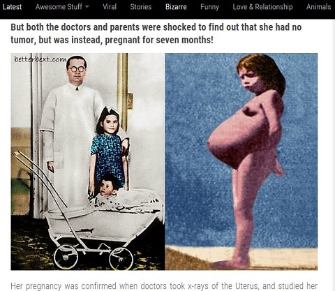 5歳で出産した「史上最年少のママ」 ― 8カ月で初潮、4歳で陰毛…性早熟症の不思議の画像1