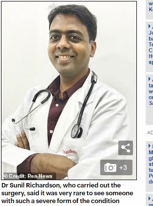 突然顔が変形&巨大化する「ライオン病」の謎！ 現代医療に見放された患者の苦悩＝印の画像2