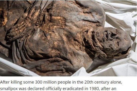 リトアニアの「ミイラ医療」の実態 ― 200体のミイラが自ら検診にやってくる死の部屋で行われていることの画像3