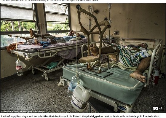 消毒なしの手術、段ボールのベッド、這いまわるネズミ… 無政府状態ベネズエラの病院は地獄だった！の画像3