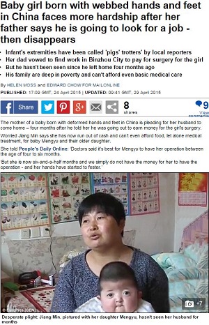 「豚足」の赤ちゃん誕生 ― 苦しみを助長する貧困問題＝中国の画像1