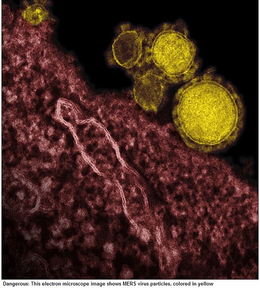 握手で感染!? 死亡率30%の奇妙なウィルス「MERSコロナウイルス」が広がっている!?の画像1