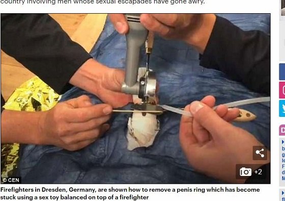 ドイツの消防士が「ペニスリング」を取り外す訓練をしていることが判明！ 肛門リンゴや尿道針も… 性具の事故急増、末期的事態の画像1