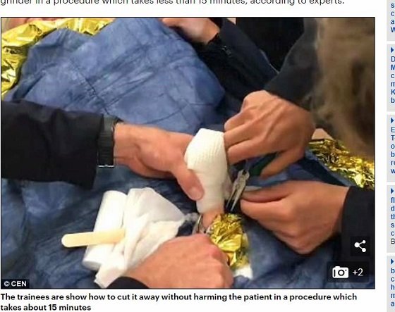 ドイツの消防士が「ペニスリング」を取り外す訓練をしていることが判明！ 肛門リンゴや尿道針も… 性具の事故急増、末期的事態の画像2