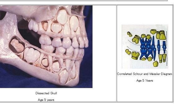 【頭蓋骨は語る】乳歯が抜ける前の子どもの口の中が衝撃的にヤバすぎる！の画像1