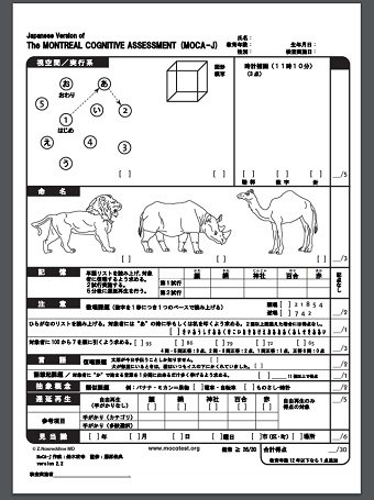 トランプが満点を取った11問の認知テスト「MoCA」が激ムズ！ 半分解けないと認知症の危険も！の画像6