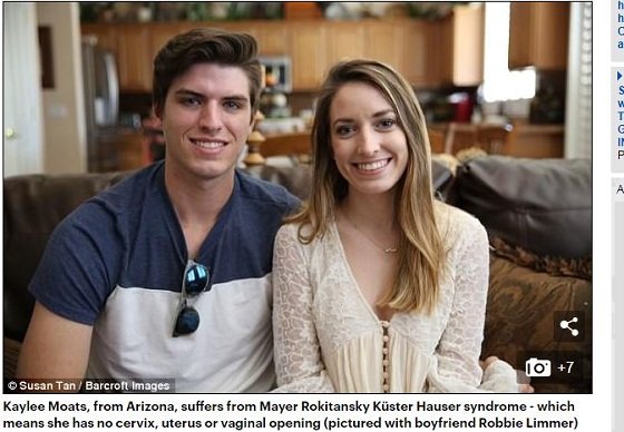 膣のない美女「MRKH症候群」の苦悩 ― 恋人に処女を捧げるため手術を決意し…の画像2