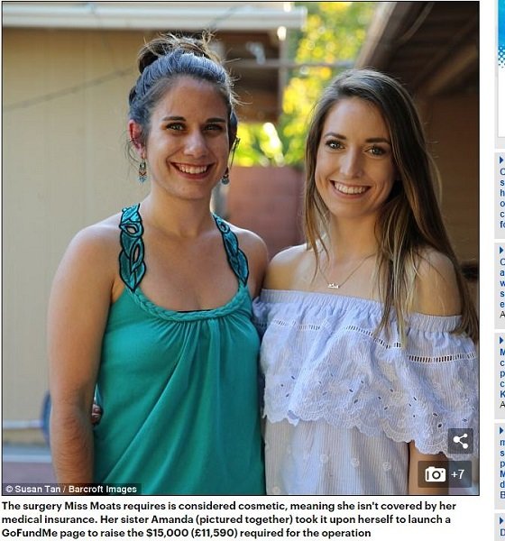 膣のない美女「MRKH症候群」の苦悩 ― 恋人に処女を捧げるため手術を決意し…の画像3