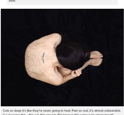 生きるのも死ぬのも怖くて ― うつ・不安障害を表現した11の写真の画像7