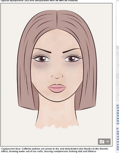 あなたは大丈夫？ 「ネトフリ顔」急増の危機… 画面を見続けると肌は劣化するの画像3