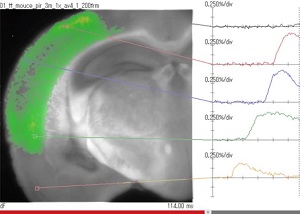 脳は考えられていたほど複雑ではなかった！ 全容解明も近いか？の画像2