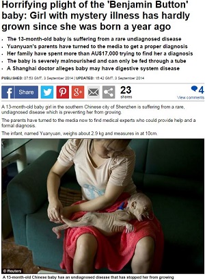 【人体の驚異】永遠に赤ちゃんのまま？ ― 小さな身体に襲い掛かる原因不明の病！の画像1