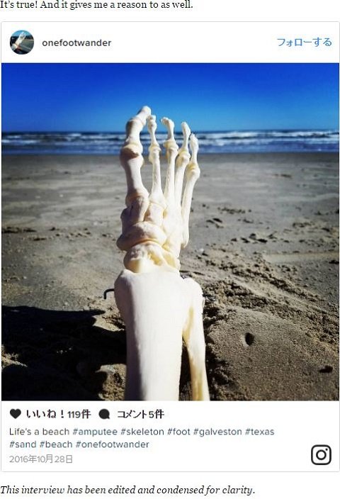 切断した足を携行しながら1本足でさまよう女が出現！ 前向きすぎる奇行の真意とは!?の画像1