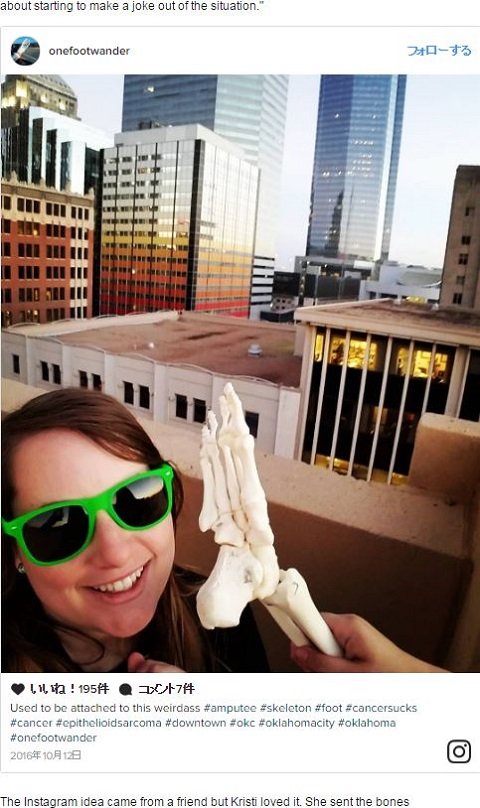 切断した足を携行しながら1本足でさまよう女が出現！ 前向きすぎる奇行の真意とは!?の画像2