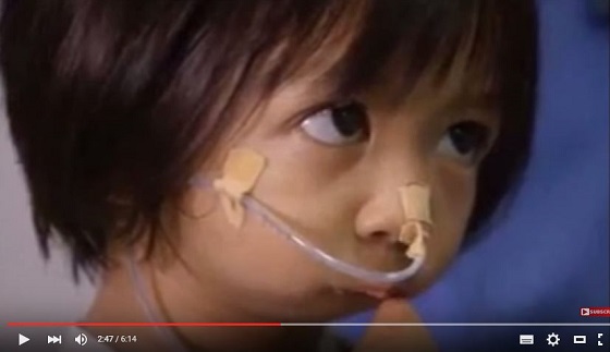 口が閉じたまま生まれた女の子が悲しすぎる！ 食べることも話すこともできず…＝比の画像1