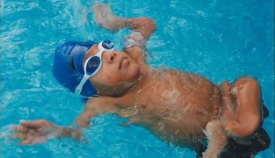 本当にグニャグニャの18歳少年 ― 身長45センチ骨折回数300を超えるスイマーの画像4