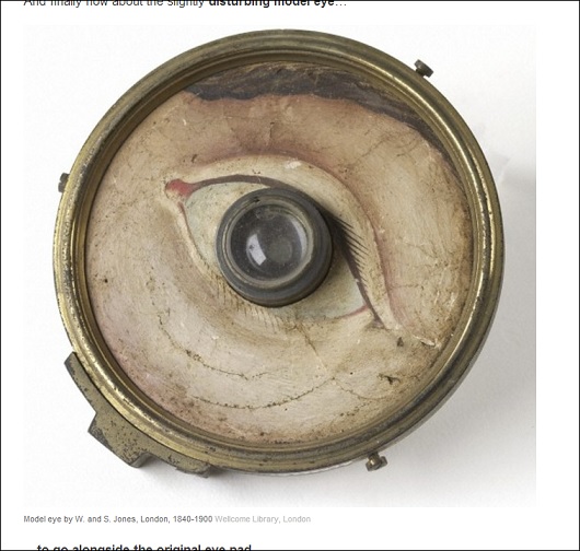 おどろおどろしい【過去の医療器具】8つ！　見てるだけで痛いーッ！の画像7