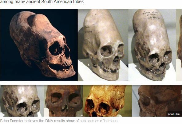 宇宙人か、新種か…パラカスの頭蓋骨に新展開！ 最新DNA鑑定で示された驚きの新事実、人類史変わるレベルか！の画像1