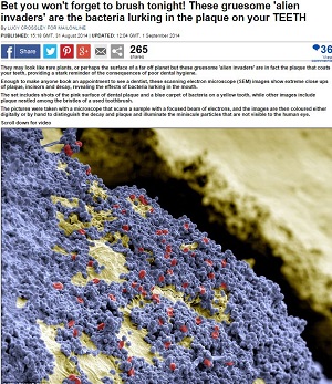 【食事中閲覧注意】歯にまとわりつくエイリアン？ 驚愕の歯垢写真！の画像1