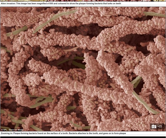 【食事中閲覧注意】歯にまとわりつくエイリアン？ 驚愕の歯垢写真！の画像2