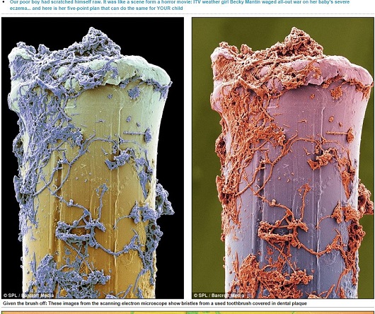 【食事中閲覧注意】歯にまとわりつくエイリアン？ 驚愕の歯垢写真！の画像3