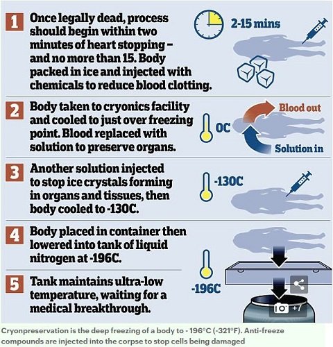 ロシアの葬儀屋が冷凍保存遺体を宇宙に打ち上げる仰天プラン発表！ 地球軌道を回りながら未来の蘇生に備えるべき理由とは？の画像5