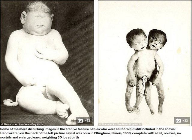 巨人症、アルビノ、結合双生児… 奇形を見世物にした19世紀のフリークショー出演者たち19人大集合！の画像1