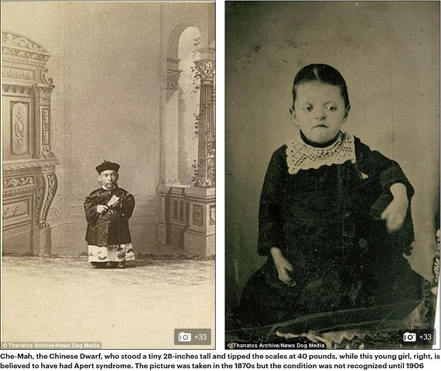 巨人症、アルビノ、結合双生児… 奇形を見世物にした19世紀のフリークショー出演者たち19人大集合！の画像4