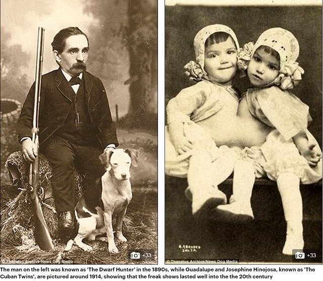 巨人症、アルビノ、結合双生児… 奇形を見世物にした19世紀のフリークショー出演者たち19人大集合！の画像7