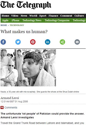 パキスタンの「ラットピープル」― 原因は近親相姦か虐待か？全員ネズミ顔の謎の画像2