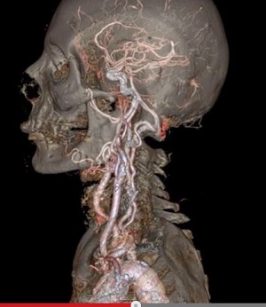 人体が全て丸見えに！ 芸術的なまでの高精細映像機能を誇る驚異のCTスキャナー！の画像1
