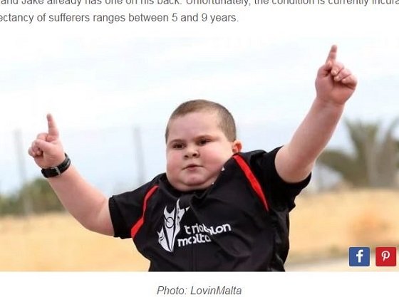 【奇病】 野菜しか食べてなくても急激に太る病「ローハド／ROHHAD」―7歳息子は何かがおかしい の画像1