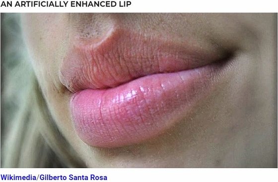 唇の形8パターンでわかる性格診断がスゴい！ 整形している人は…？の画像8