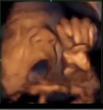 胎児はお腹の中で音楽を聴くだけでなく歌っている？ 超衝撃画像で明らかに！の画像1