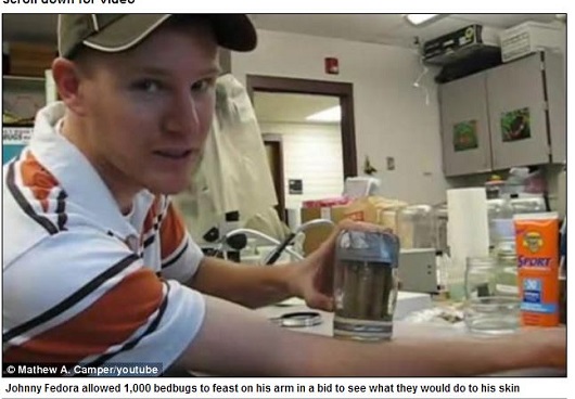 1,000匹のシラミを使ってタトゥーを彫る!? 体を張った痒～い大実験の壮絶内容！の画像1