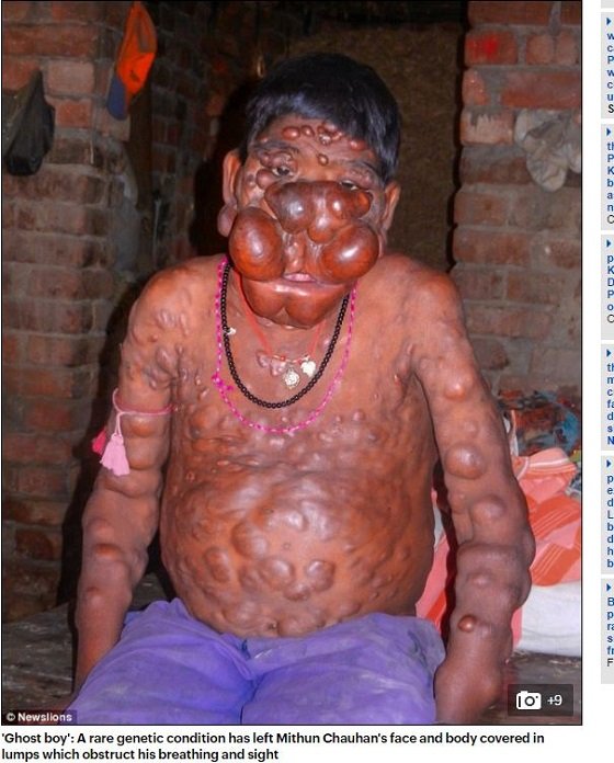 「ボクの人生に意味はあるの？」インド幽霊少年と呼ばれた子 ― 薬を服用後、誰もが恐れる姿に。その時父は…の画像1