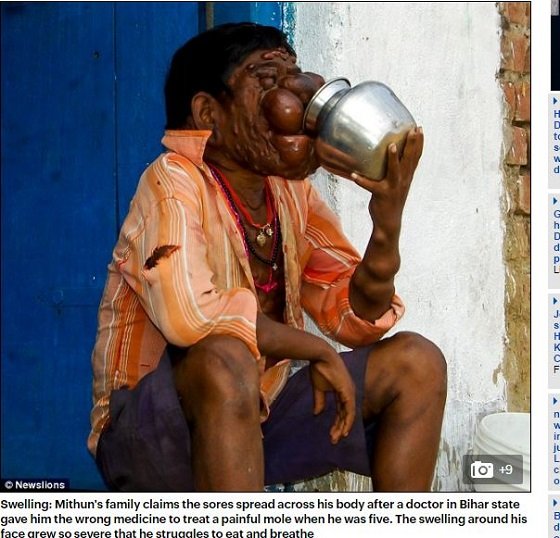 「ボクの人生に意味はあるの？」インド幽霊少年と呼ばれた子 ― 薬を服用後、誰もが恐れる姿に。その時父は…の画像3