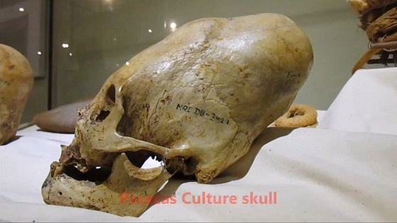 ペルーで再び「長頭頭蓋骨」が発見される！ DNA鑑定では「ヒトに非ず」…グレイ型のミイラか!?の画像1