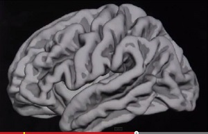 まるでニュータイプ？ 元気いっぱい「スーパー老人」の脳に隠された謎の画像1