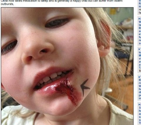 寝ない、食べない、痛くない!? 世界にたった1人超人少女の体に隠された秘密とは？の画像2